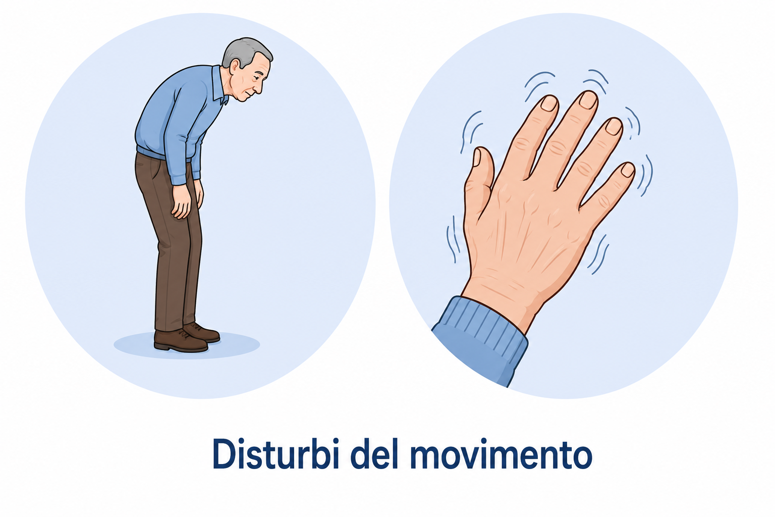 Disturbi del movimento